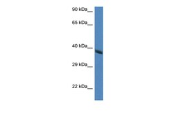 Aviva Systems Biology Corp Hao2 Antibody - middle region (ARP41435_P050)