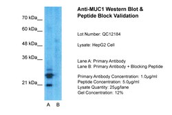 Aviva Systems Biology Corp MUC1 Antibody - C-terminal region (ARP41445_P050)