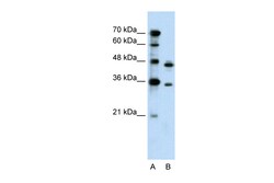 Aviva Systems Biology Corp PRPS2 Antibody - middle region (ARP41448_P050)