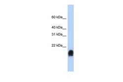 Aviva Systems Biology Corp MUC1 Antibody - middle region (ARP41456_P050)