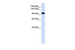 Aviva Systems Biology Corp ACTN2 Antibody - N-terminal region (ARP41462_P050)
