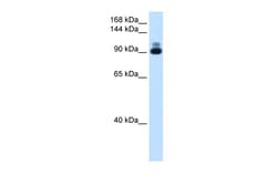 Aviva Systems Biology Corp ACTN2 Antibody - C-terminal region (ARP41463_T100)