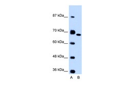 Aviva Systems Biology Corp FN1 Antibody - C-terminal region (ARP41490_P050)