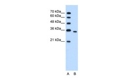 Aviva Systems Biology Corp PRPS2 Antibody - N-terminal region (ARP41509_T100)