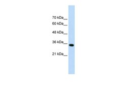 Aviva Systems Biology Corp ADAMTS4 Antibody - N-terminal region (ARP41556_P050)
