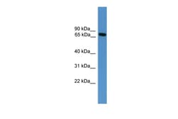 Aviva Systems Biology Corp Masp2 Antibody - middle region (ARP41575_P050)