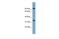 Aviva Systems Biology Corp SDS Antibody - middle region (ARP41583_P050)