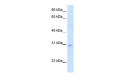 Aviva Systems Biology Corp LDB3 Antibody - N-terminal region (ARP41588_T100)