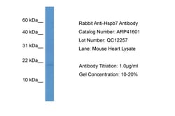 Aviva Systems Biology Corp Hspb7 Antibody - C-terminal region (ARP41601_P050)