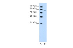 Aviva Systems Biology Corp CHST7 Antibody - middle region (ARP41615_T100)