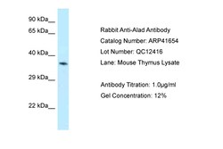 Aviva Systems Biology Corp Alad Antibody - N-terminal region (ARP41654_P050)