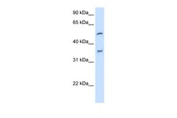 Aviva Systems Biology Corp CYP2D6 Antibody - N-terminal region (ARP41675_T100)