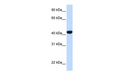 Aviva Systems Biology Corp FAH Antibody - N-terminal region (ARP41680_P050)