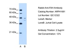 Aviva Systems Biology Corp FAH Antibody - C-terminal region (ARP41681_T100)