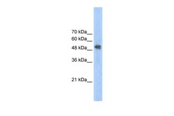 Aviva Systems Biology Corp FECH Antibody - N-terminal region (ARP41682_T100)
