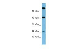 Aviva Systems Biology Corp LEP Antibody - N-terminal region (ARP41697_P050)