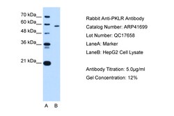 Aviva Systems Biology Corp PKLR Antibody - N-terminal region (ARP41699_T100)