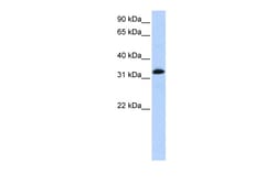 Aviva Systems Biology Corp TNNT2 Antibody - N-terminal region (ARP41717_P050)