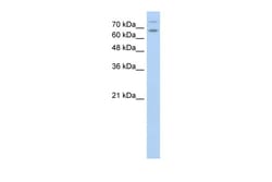 Aviva Systems Biology Corp TSHR Antibody - N-terminal region (ARP41721_P050)