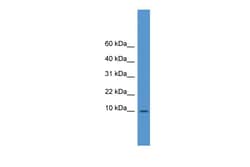 Aviva Systems Biology Corp IAPP Antibody - N-terminal region (ARP41728_P050)