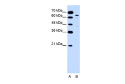 Aviva Systems Biology Corp KRT2A Antibody - middle region (ARP41735_P050)