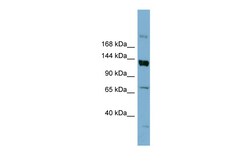 Aviva Systems Biology Corp ABCB4 Antibody - middle region (ARP41742_P050)