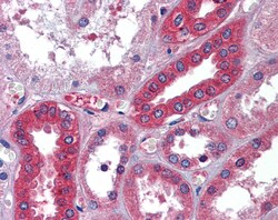 Aviva Systems Biology Corp ALB Antibody - middle region (ARP41746_P050)