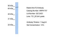Aviva Systems Biology Corp F2 Antibody - middle region (ARP41757_P050)