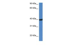 Aviva Systems Biology Corp Otc Antibody - C-terminal region (ARP41767_P050)