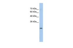 Aviva Systems Biology Corp GSTM1 Antibody - N-terminal region (ARP41769_P050)