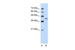 Aviva Systems Biology Corp BDKRB2 Antibody - N-terminal region (ARP41781_T100)