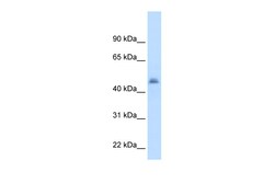Aviva Systems Biology Corp CYP3A7 Antibody - middle region (ARP41801_T100)