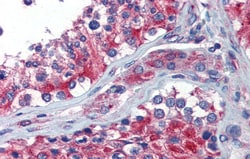 Aviva Systems Biology Corp NPY1R Antibody - middle region (ARP41827_P050)