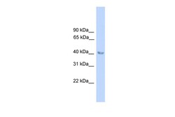 Aviva Systems Biology Corp ALAD Antibody - N-terminal region (ARP41845_P050)