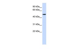 Aviva Systems Biology Corp CYB561 Antibody - middle region (ARP41868_P050)