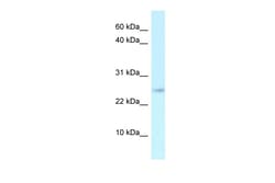 Aviva Systems Biology Corp Arpp21 Antibody - N-terminal region (ARP41873_P050)