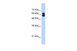 Aviva Systems Biology Corp ALPP Antibody - C-terminal region (ARP41959_T100)