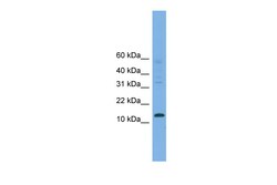 Aviva Systems Biology Corp CRABP2 Antibody - middle region (ARP41982_P050)