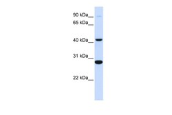 Aviva Systems Biology Corp CYB561 Antibody - middle region (ARP41992_P050)