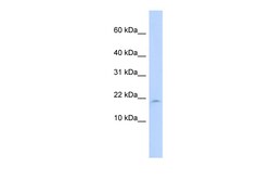 Aviva Systems Biology Corp LAIR2 Antibody - N-terminal region (ARP42032_P050)
