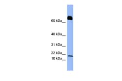 Aviva Systems Biology Corp PF4V1 Antibody - middle region (ARP42053_P050)