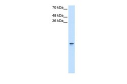 Aviva Systems Biology Corp RBP1 Antibody - middle region (ARP42081_T100)