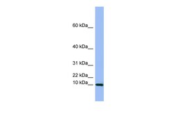 Aviva Systems Biology Corp SEMG1 Antibody - middle region (ARP42089_P050)