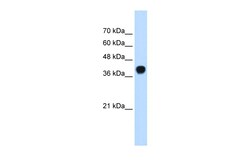 Aviva Systems Biology Corp SQLE Antibody - C-terminal region (ARP42101_P050)