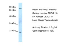 Aviva Systems Biology Corp Timp2 Antibody - C-terminal region (ARP42116_P050)