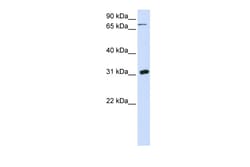 Aviva Systems Biology Corp UPP1 Antibody - N-terminal region (ARP42125_P050)