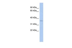 Aviva Systems Biology Corp UPP1 Antibody - middle region (ARP42126_P050)