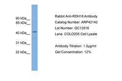 Aviva Systems Biology Corp RDH16 Antibody - middle region (ARP42142_P050)