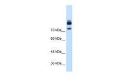 Aviva Systems Biology Corp MTMR1 Antibody - C-terminal region (ARP42149_T100)