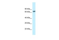 Aviva Systems Biology Corp Btrc Antibody - C-terminal region (ARP42160_P050)